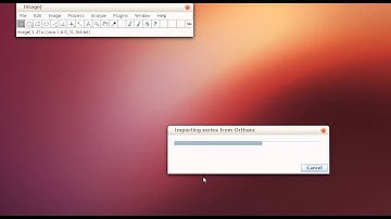 ImageJ plugin to import DICOM images from Orthanc