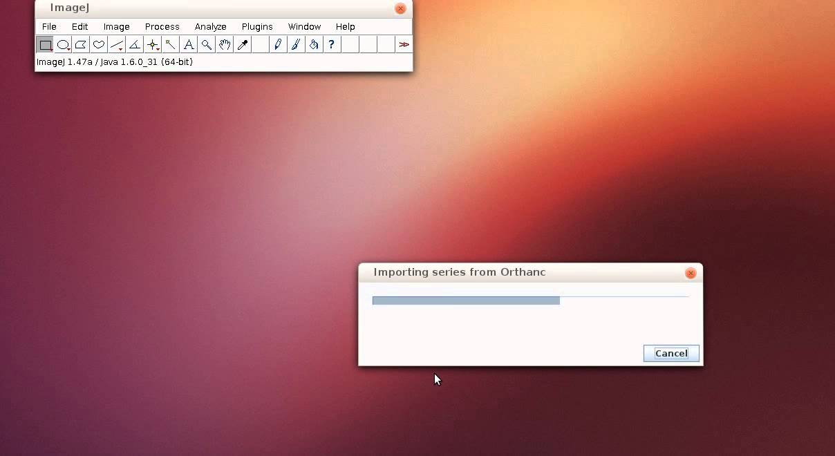 Imagej Plugin To Import Dicom Images From Orthanc
