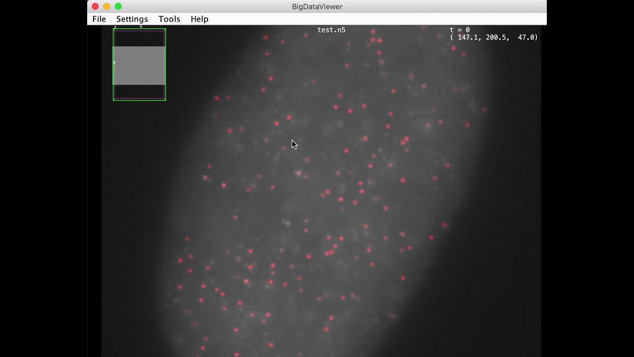 Visualizing smFISH spots detected with RS-FISH using BigDataViewer