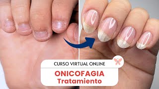 Muestra De Curso Tratamiento De Onicofagia