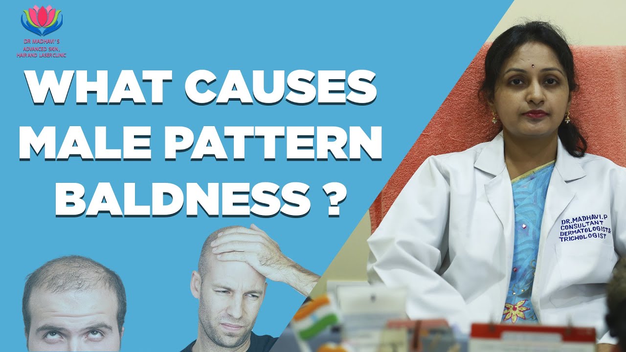 WHAT CAUSES MALE PATTERN BALDNESS ? | Dr.Madhavi's Advanced Skin Hair and Laser Clinic