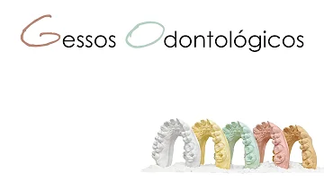 O que significa o tempo de trabalho do gesso odontológico?