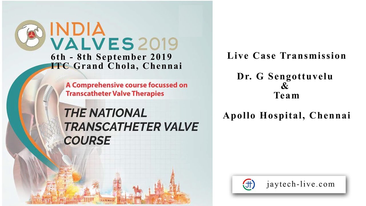 India Valves 2019 - Live Case TX - Dr. G Sengottuvelu, Apollo Hospital, Chennai
