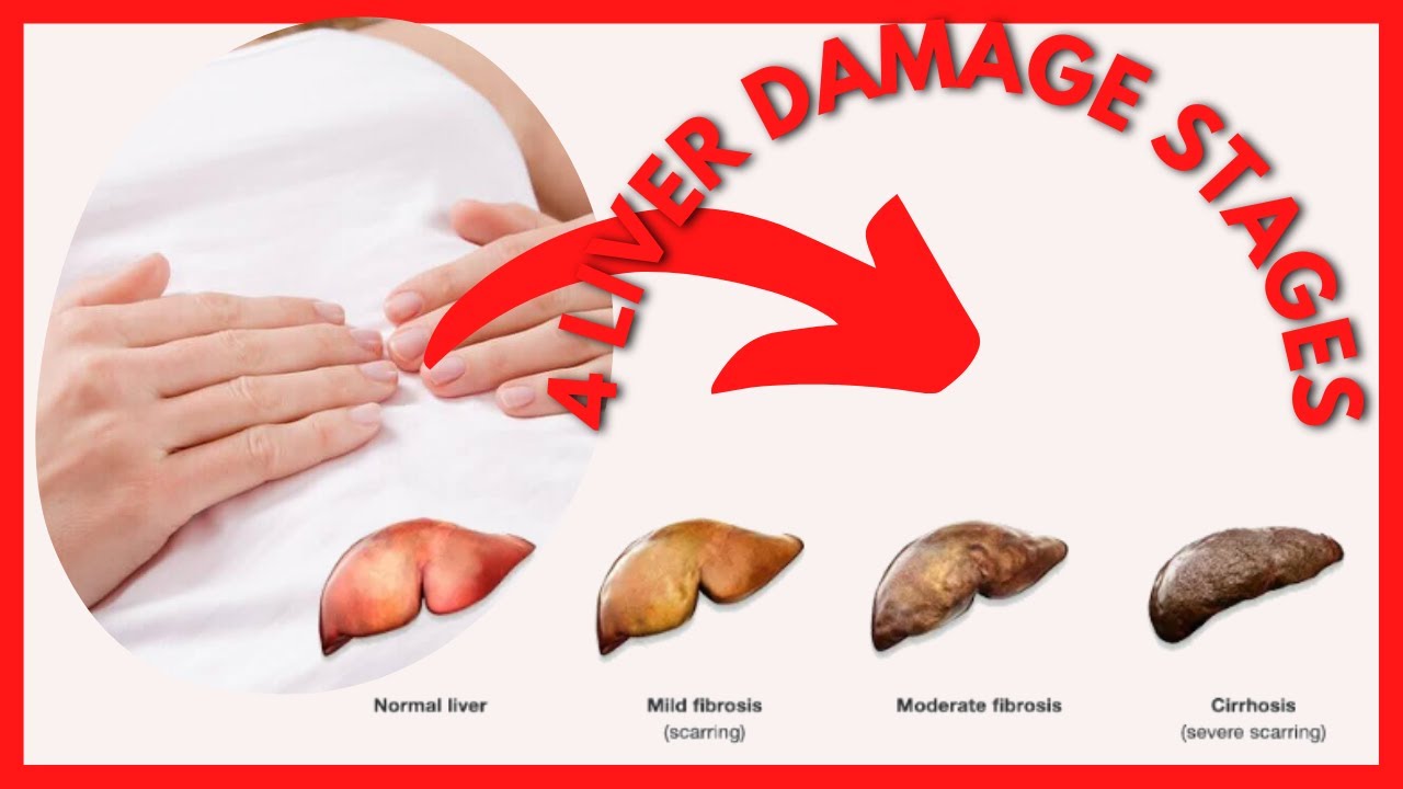 Does Liver Damage Show Up In Blood Tests Does Liver Damage Show Up In Blood Tests