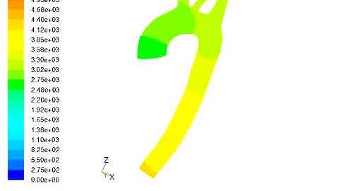 FSI simulation of aortic arch