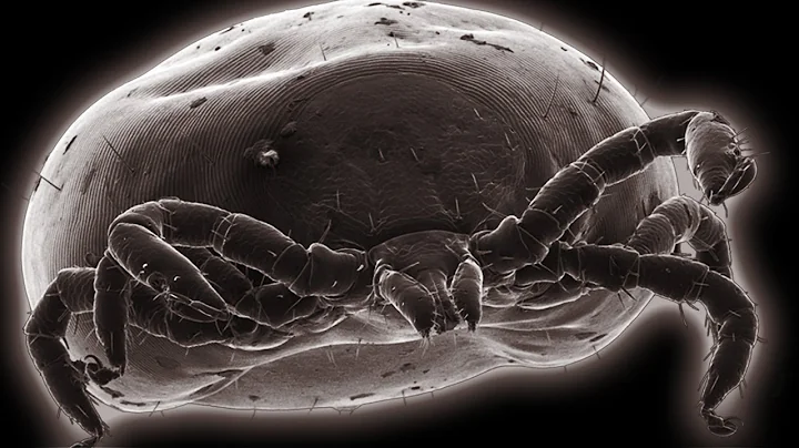 This sucks your blood! Sheep Tick | SEM | BBC Earth Explore