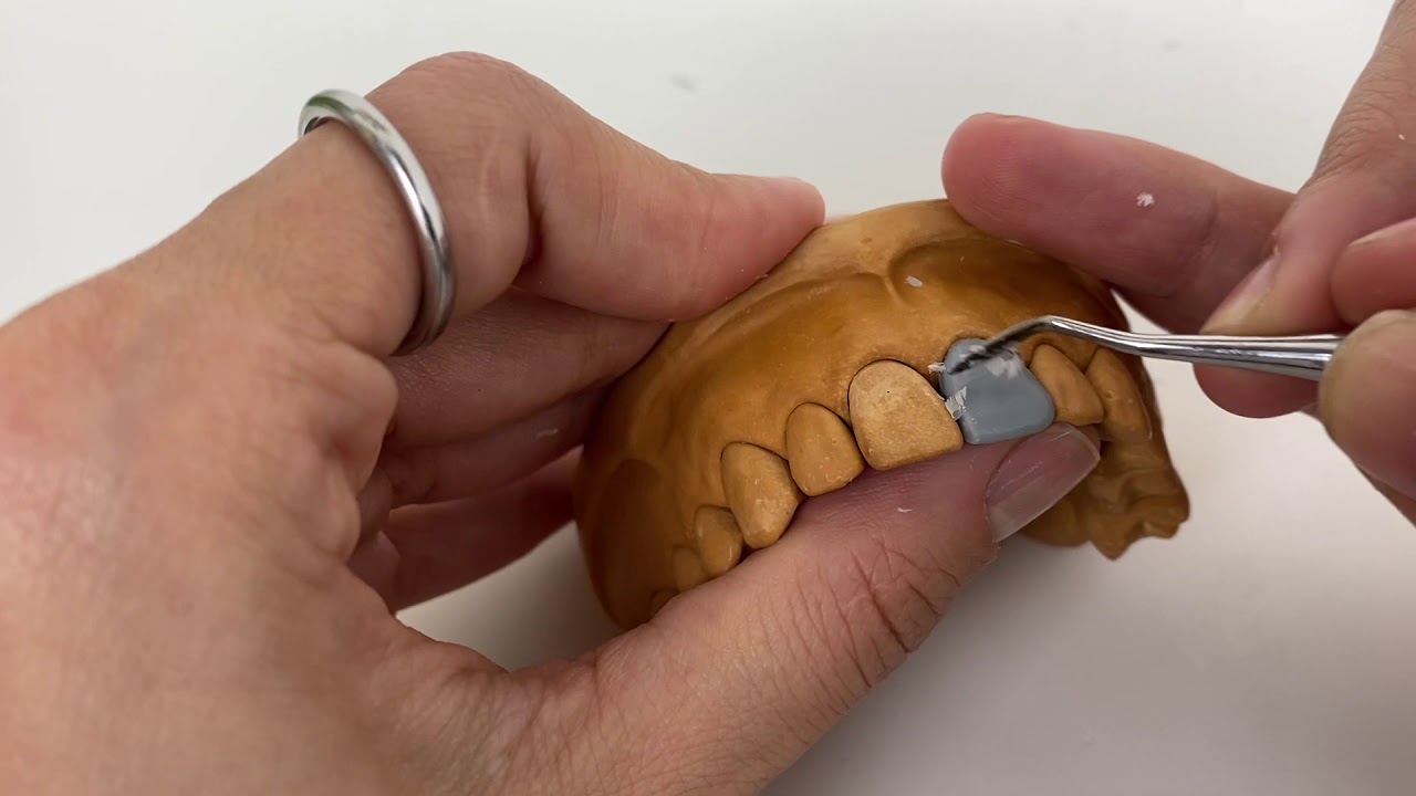 Do It Yourself - Morfología y encerado de un incisivo central.