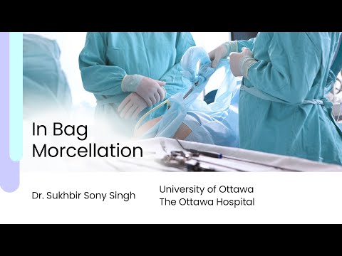 MorSafe - Tissue Morcellation Bag | Veol Medical Technologies Pvt. Ltd.