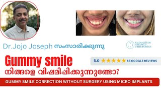 Gummy smile  നിങ്ങളെ വിഷമിപ്പിക്കുന്നുണ്ടോ ? ഇതൊന്നു കണ്ടുനോക്കൂ