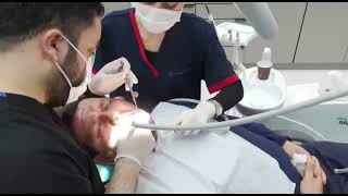 تجميل الأسنان في تركيا - أفضل عيادات التجميل في اسطنبول