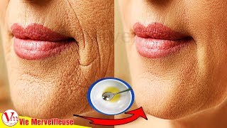 Comment se débarrasser des rides autour de la bouche ?