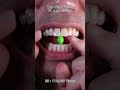 Satisfying Chewing ASMR #Compilation #ASMR #DoctorTristanPeh