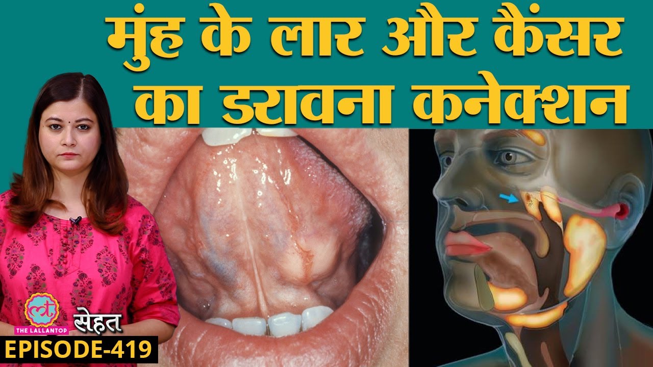 Tasty Food देख लार बहती है? अब इससे जुड़े Salivary Gland Cancer के बारे में जान लें | Sehat ep 419
