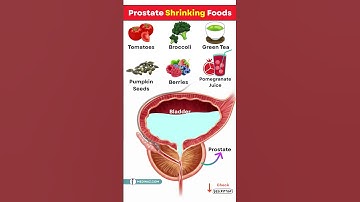 Men, Don’t Ignore This! Top 10 Prostate Friendly Foods