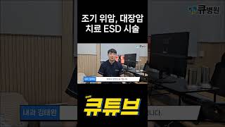 조기위암 대장암 치료 ESD