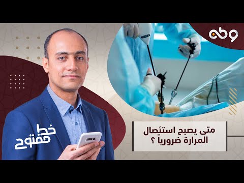 خط مفتوح متى يصبح استئصال المرارة ضروريا