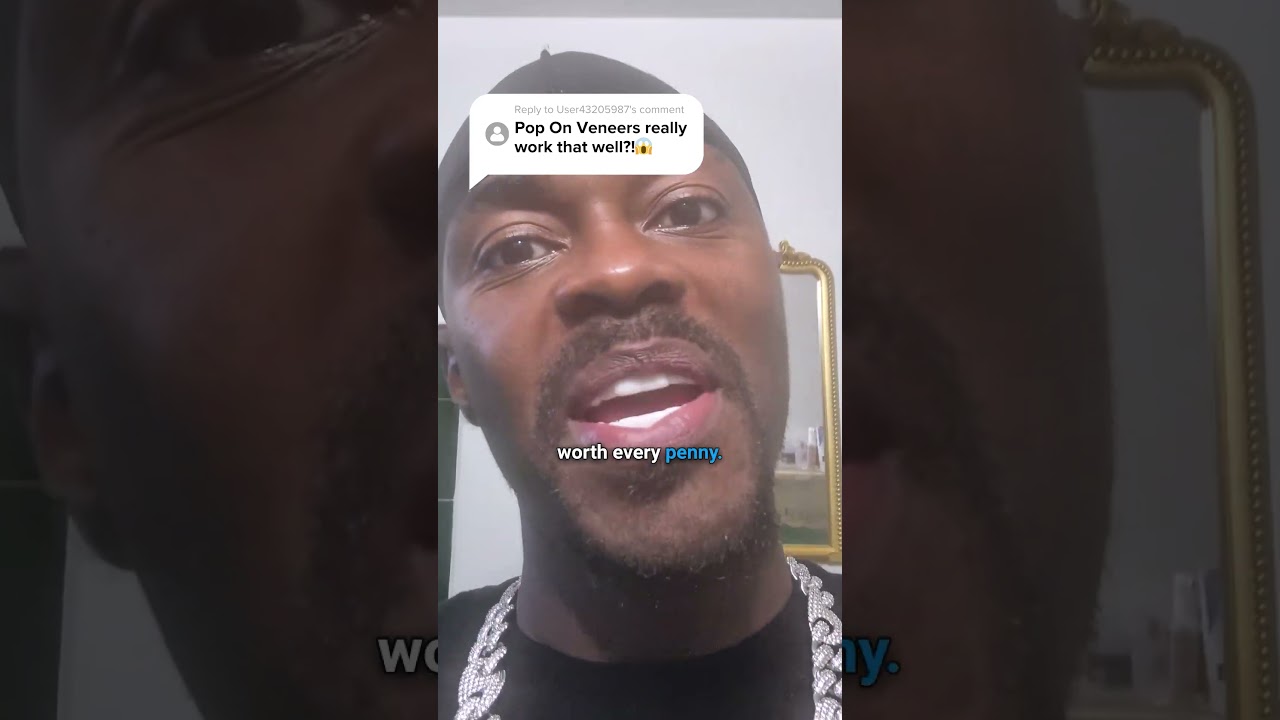 A smile upgrade worth every penny💯 