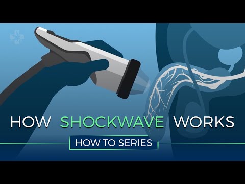 How Shockwave Therapy Works - HOW TO SERIES