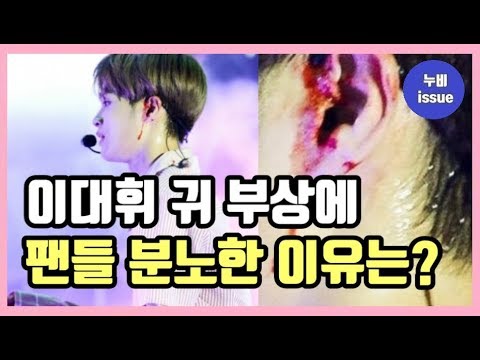 [이슈] 워너원 이대휘 귀 부상에 팬들 분노한 이유는? | issue | 누비 NuBi