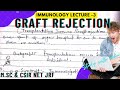Graft rejection | Genetic predisposition for graft rejection , prevantation of graft rejection msc |