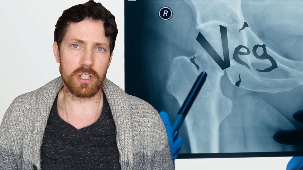 RE: Vegetarian Women Have 33% More Hip Fractures