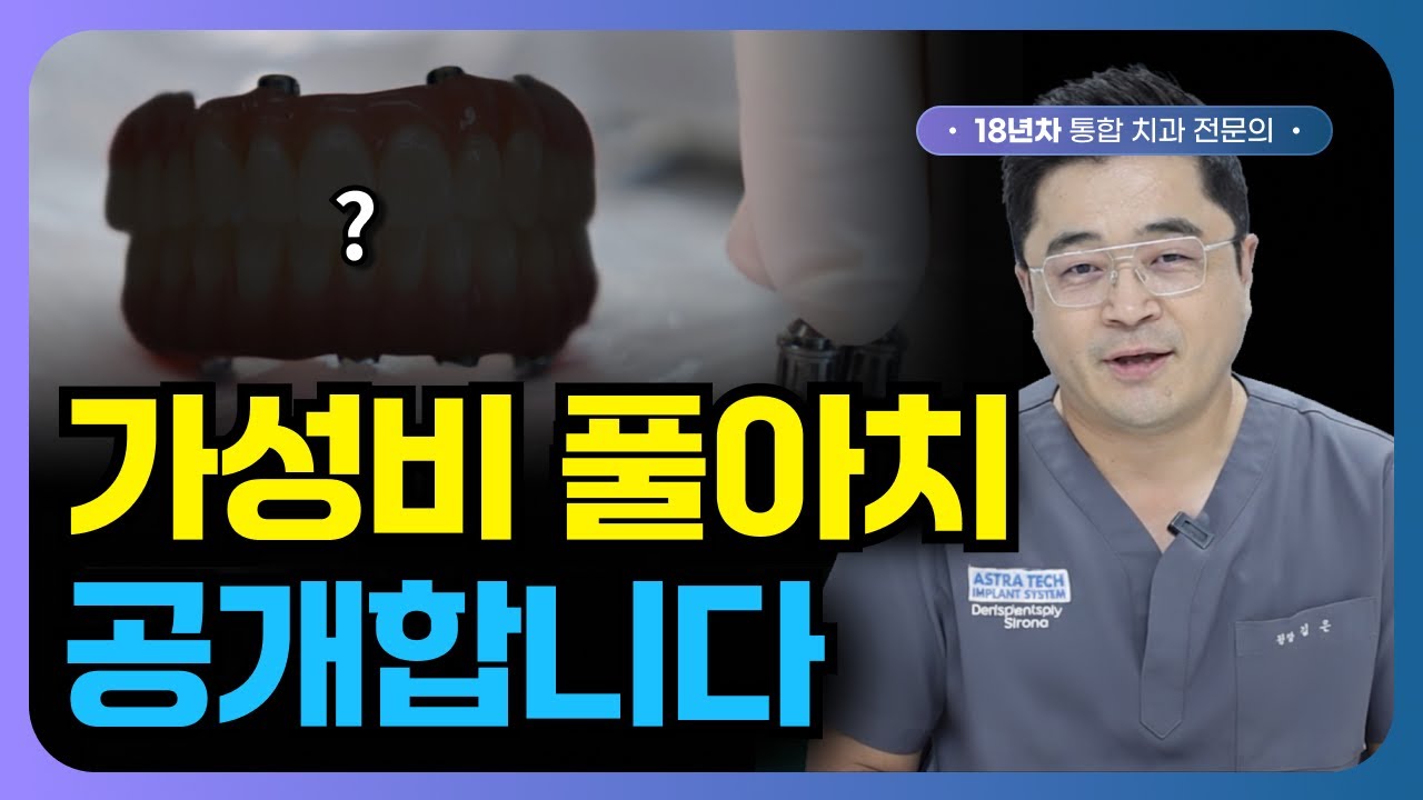 풀아치 임플란트 저렴하게 하는 방법 공개합니다 (가성비 풀아치)