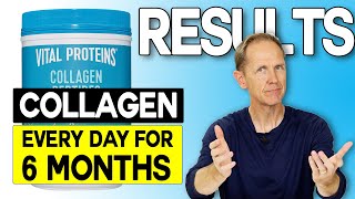 Vital Proteins Collagen Peptides | Results