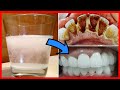 This secret recipe from a Chinese dentist removes plaque and whitens teeth in just two minutes!