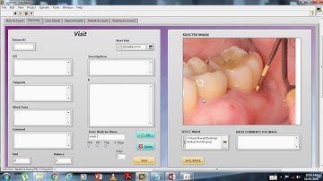 LABVIEW database connection example | Database for Hospitals  | Labview Practical Example