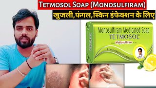 Tetmosol soap Review | दाद खुजली के लिए बेस्ट साबुन | tetmosol sabun | monosulfiram /Medical Jankari