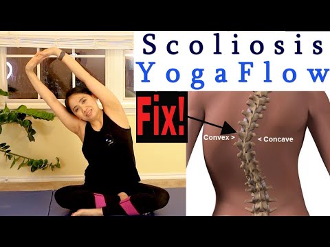 Gentle 15 minute Evening Yoga Flow for Dextroscoliosis or Levoscoliosis Relief