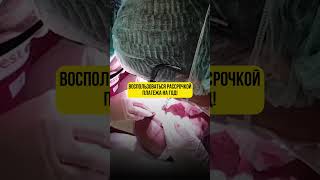 Любая зона пересадки за 50.000 рублей.