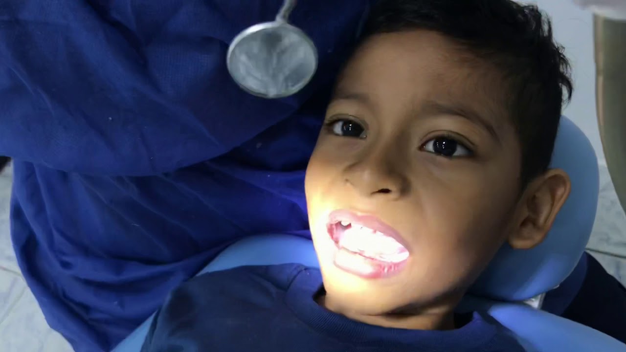 Profilaxis y fluorización en paciente pediatrico 👩🏻‍⚕️🦷 - Odontopediatria I