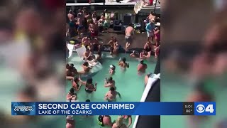 Health officials report 2nd COVID-19 case from Lake of the Ozarks parties