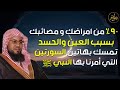 الشنقيطي 90 من مصائبك وأمراضك بسبب العين علامات إن ظهرت عليك فاعلم أنك محسود 