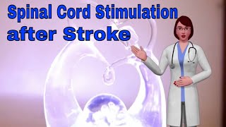 Spinal Cord Stimulation May Restore Arm & Hand Mobility After Stroke