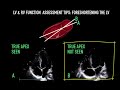 LV function: pearls & pitfalls in visual assessment