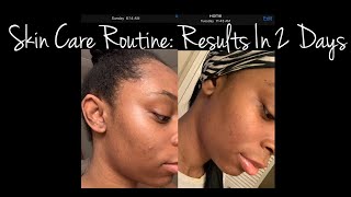 My Skin Care Routine 2 Day Results