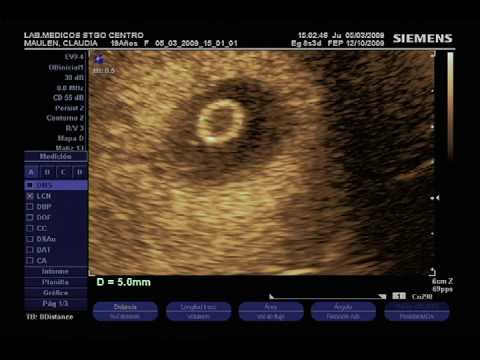 Cuanto mide un bb de 2 meses de embarazo