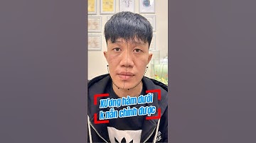 Lệch hàm dứoi có nắn chỉnh được không? #matlech #nanmat #hungtrilieu