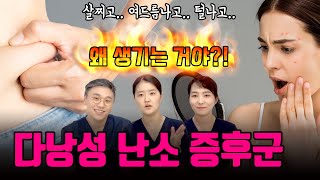 제 '난소'가 아픈 건가요? 다낭성난소증후군, 도대체 뭐길래?!!!