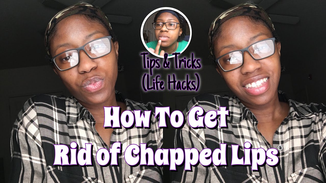 How To Get Rid of Chapped Lips (Dry) + Lip Care Routine 2020 (Tips &Tricks) - YouTube