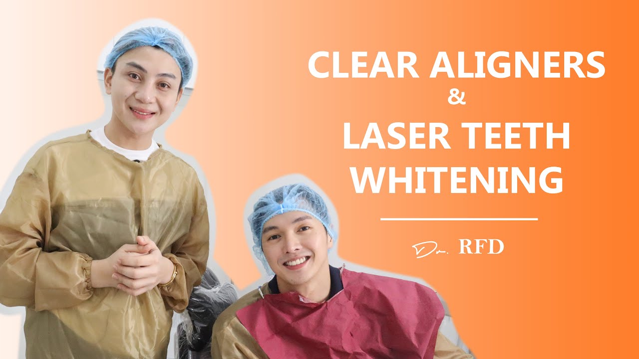 Clear Aligners & Laser Teeth Whitening Dr. RFD YouTube