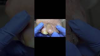 Satisfactory manicure video nail decompression pedicure