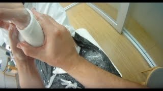 Plaster Cast Application For Broken Wrist POV