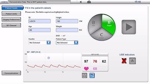 How to setup minimally invasive hemodynamic monitoring using LiDCO