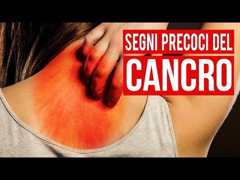 Video: Il Sole Baciò. Bellezze Russe Attrici Con Le Lentiggini