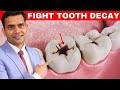 Healthy and Strong  | fight Tooth Decay | Avoid Cavities