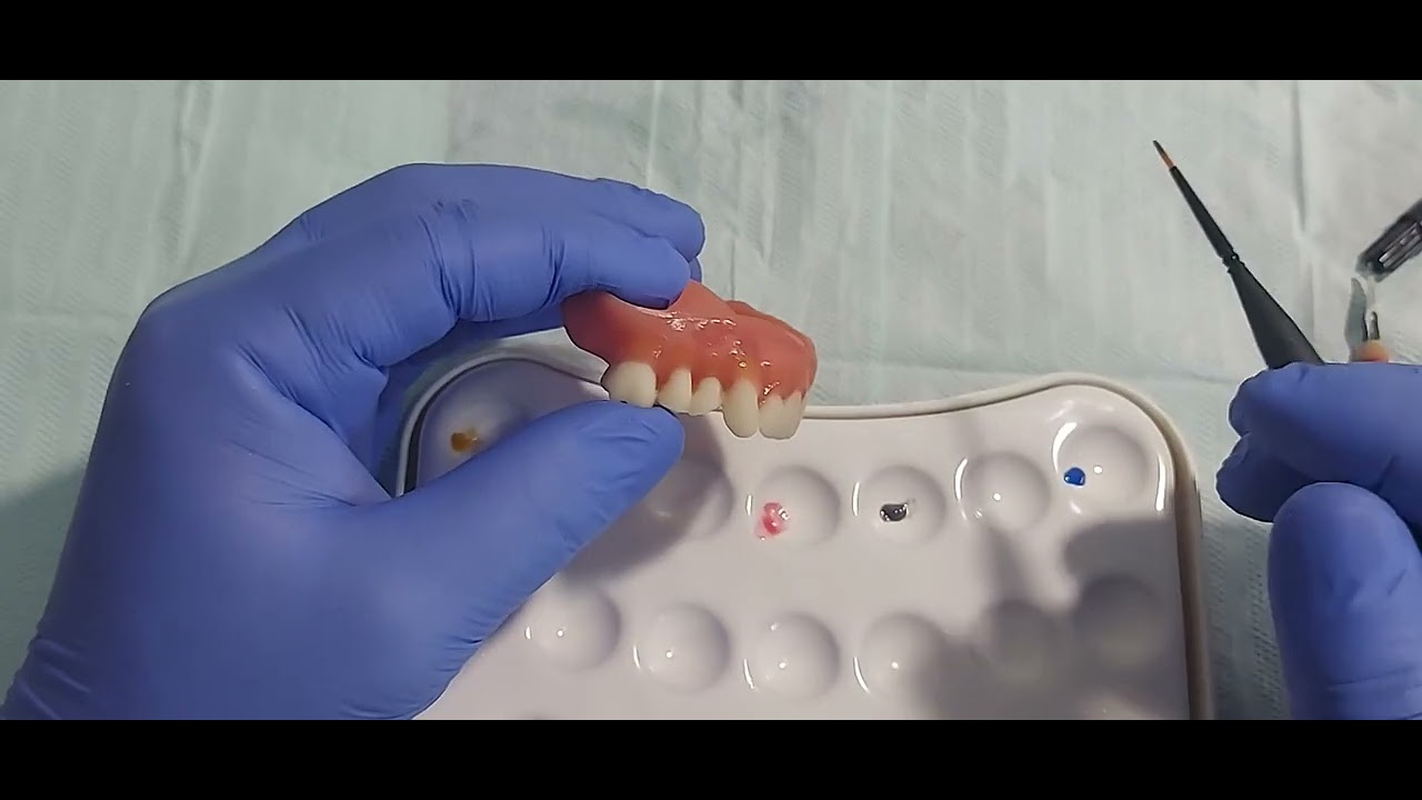 Maquiagem  de uma Prótese Total Impressa com Resina  3D e instalação direto em boca.