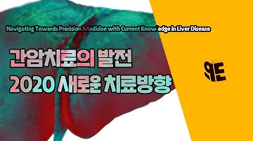 간세포암 치료 전략에 새로운 지평을 열다-